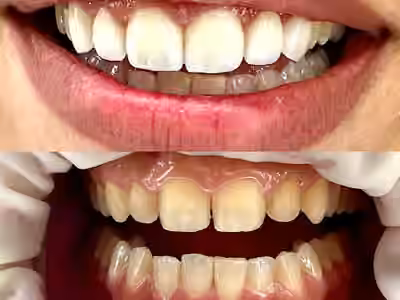 Cartagena Smile Studio I Dra. Katherine Prins Barco