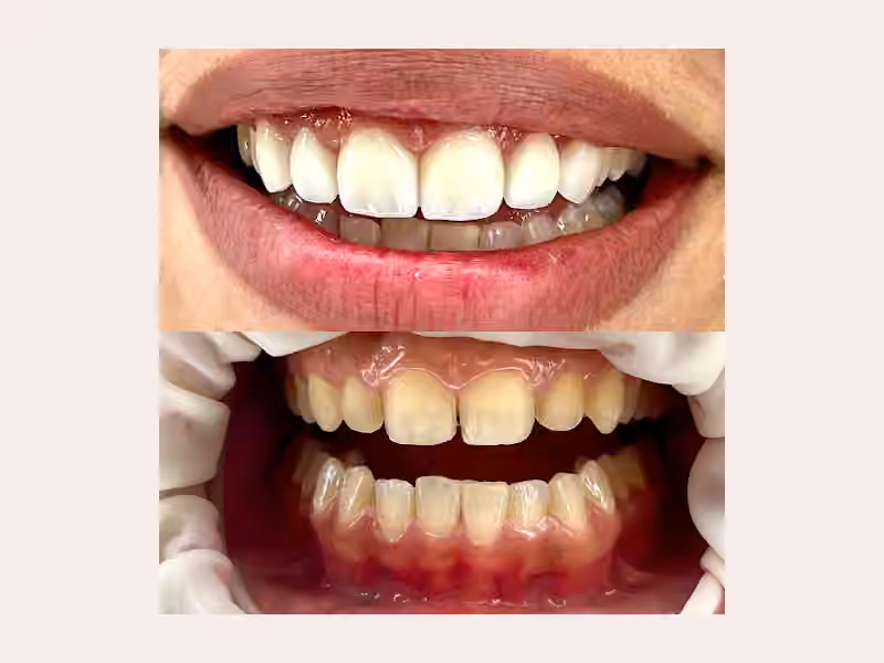 Cartagena Smile Studio I Dra. Katherine Prins Barco