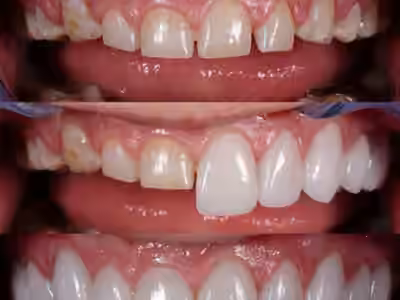 Odontologos Cartagena / Precios odontologia Cartagena/ Clinica dental Cartagena