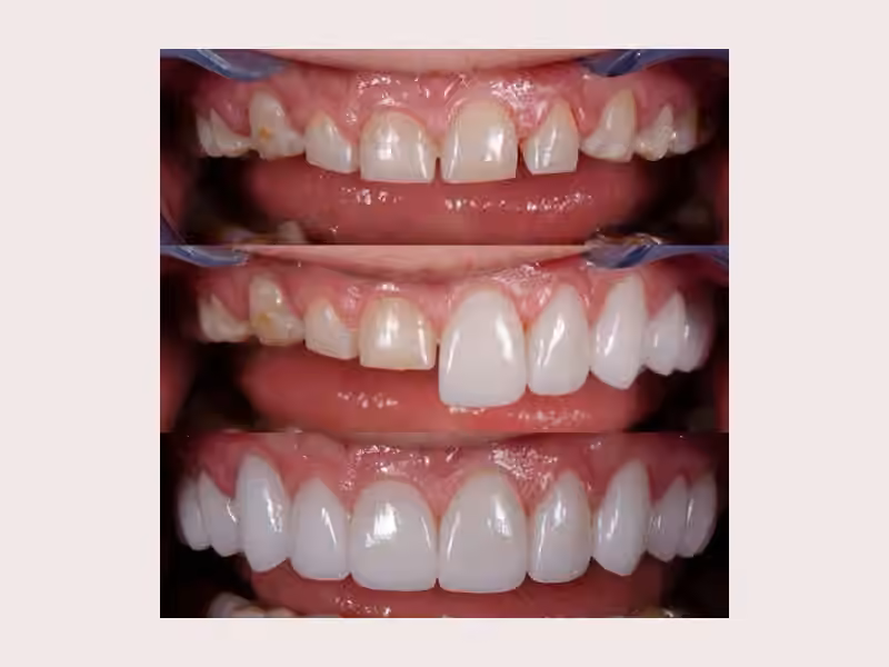 Odontologos Cartagena / Precios odontologia Cartagena/ Clinica dental Cartagena