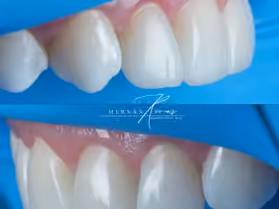 Hernán Rivas Odontología Estética