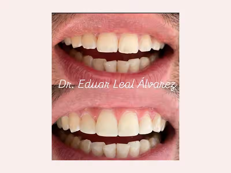 Consultorio Odontológico Dr. Eduar Leal Álvarez