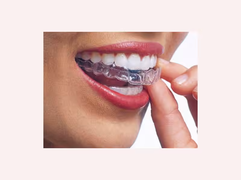 Odonto K