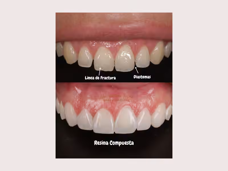 Dr. Antonio Frias - Odontología Estética