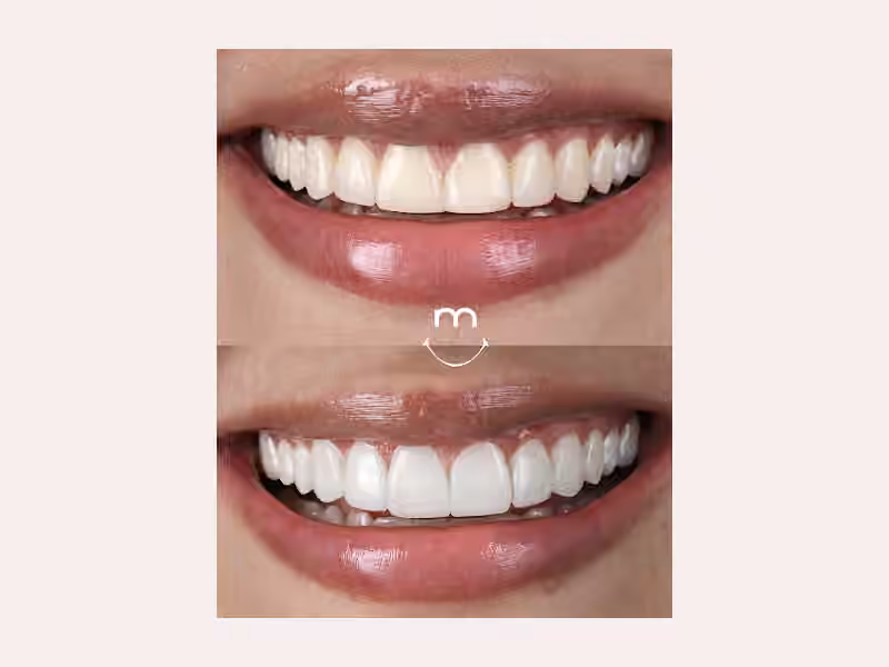 Odontología The Best Smile Centro Medellín