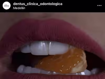 Dentus Odontologia Integral