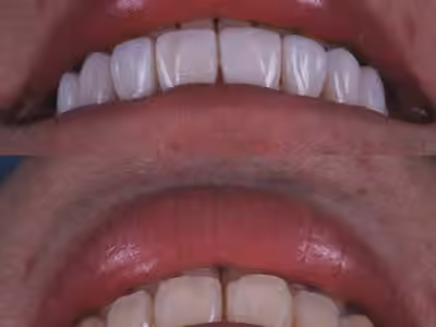 DENTAL PREMIUM By STIWEN RUALES