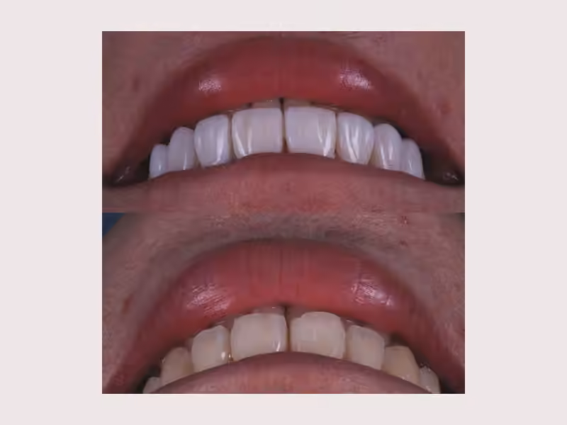 DENTAL PREMIUM By STIWEN RUALES